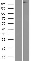 Western blot validation of overexpression lysate (Cat# LY426808) using anti-DDK antibody (Cat# TA50011-100). Left: Cell lysates from un-transfected HEK293T cells; Right: Cell lysates from HEK293T cells transfected with RC226492 using transfection reagent MegaTran 2.0 (Cat# TT210002).
