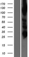 Western blot validation of overexpression lysate (Cat# LY412369) using anti-DDK antibody (Cat# TA50011-100). Left: Cell lysates from un-transfected HEK293T cells; Right: Cell lysates from HEK293T cells transfected with RC223715 using transfection reagent MegaTran 2.0 (Cat# TT210002).