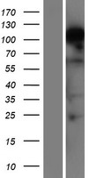 Western blot validation of overexpression lysate (Cat# LY404331) using anti-DDK antibody (Cat# TA50011-100). Left: Cell lysates from un-transfected HEK293T cells; Right: Cell lysates from HEK293T cells transfected with RC224940 using transfection reagent MegaTran 2.0 (Cat# TT210002).