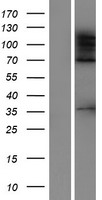 Western blot validation of overexpression lysate (Cat# LY414944) using anti-DDK antibody (Cat# TA50011-100). Left: Cell lysates from un-transfected HEK293T cells; Right: Cell lysates from HEK293T cells transfected with RC209813 using transfection reagent MegaTran 2.0 (Cat# TT210002).