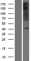 Western blot validation of overexpression lysate (Cat# LY404891) using anti-DDK antibody (Cat# TA50011-100). Left: Cell lysates from un-transfected HEK293T cells; Right: Cell lysates from HEK293T cells transfected with RC214881 using transfection reagent MegaTran 2.0 (Cat# TT210002).