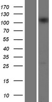 Western blot validation of overexpression lysate (Cat# LY410734) using anti-DDK antibody (Cat# TA50011-100). Left: Cell lysates from un-transfected HEK293T cells; Right: Cell lysates from HEK293T cells transfected with RC209283 using transfection reagent MegaTran 2.0 (Cat# TT210002).