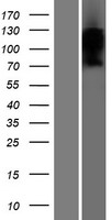 Western blot validation of overexpression lysate (Cat# LY411050) using anti-DDK antibody (Cat# TA50011-100). Left: Cell lysates from un-transfected HEK293T cells; Right: Cell lysates from HEK293T cells transfected with RC219636 using transfection reagent MegaTran 2.0 (Cat# TT210002).