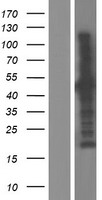 Western blot validation of overexpression lysate (Cat# LY421699) using anti-DDK antibody (Cat# TA50011-100). Left: Cell lysates from un-transfected HEK293T cells; Right: Cell lysates from HEK293T cells transfected with RC206209 using transfection reagent MegaTran 2.0 (Cat# TT210002).