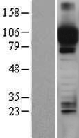 Western blot validation of overexpression lysate (Cat# LY400806) using anti-DDK antibody (Cat# TA50011-100). Left: Cell lysates from un-transfected HEK293T cells; Right: Cell lysates from HEK293T cells transfected with RC219753 using transfection reagent MegaTran 2.0 (Cat# TT210002).