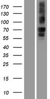 Western blot validation of overexpression lysate (Cat# LY414407) using anti-DDK antibody (Cat# TA50011-100). Left: Cell lysates from un-transfected HEK293T cells; Right: Cell lysates from HEK293T cells transfected with RC224704 using transfection reagent MegaTran 2.0 (Cat# TT210002).