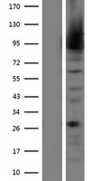 Western blot validation of overexpression lysate (Cat# LY406281) using anti-DDK antibody (Cat# TA50011-100). Left: Cell lysates from un-transfected HEK293T cells; Right: Cell lysates from HEK293T cells transfected with RC204322 using transfection reagent MegaTran 2.0 (Cat# TT210002).