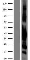 Western blot validation of overexpression lysate (Cat# LY419561) using anti-DDK antibody (Cat# TA50011-100). Left: Cell lysates from un-transfected HEK293T cells; Right: Cell lysates from HEK293T cells transfected with RC205289 using transfection reagent MegaTran 2.0 (Cat# TT210002).