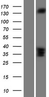Western blot validation of overexpression lysate (Cat# LY416330) using anti-DDK antibody (Cat# TA50011-100). Left: Cell lysates from un-transfected HEK293T cells; Right: Cell lysates from HEK293T cells transfected with RC223580 using transfection reagent MegaTran 2.0 (Cat# TT210002).