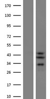 Western blot validation of overexpression lysate (Cat# LY410591) using anti-DDK antibody (Cat# TA50011-100). Left: Cell lysates from un-transfected HEK293T cells; Right: Cell lysates from HEK293T cells transfected with RC208960 using transfection reagent MegaTran 2.0 (Cat# TT210002).