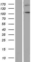 Western blot validation of overexpression lysate (Cat# LY406108) using anti-DDK antibody (Cat# TA50011-100). Left: Cell lysates from un-transfected HEK293T cells; Right: Cell lysates from HEK293T cells transfected with RC213515 using transfection reagent MegaTran 2.0 (Cat# TT210002).