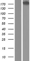 Western blot validation of overexpression lysate (Cat# LY407863) using anti-DDK antibody (Cat# TA50011-100). Left: Cell lysates from un-transfected HEK293T cells; Right: Cell lysates from HEK293T cells transfected with RC215288 using transfection reagent MegaTran 2.0 (Cat# TT210002).