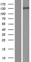 Western blot validation of overexpression lysate (Cat# LY420218) using anti-DDK antibody (Cat# TA50011-100). Left: Cell lysates from un-transfected HEK293T cells; Right: Cell lysates from HEK293T cells transfected with RC222989 using transfection reagent MegaTran 2.0 (Cat# TT210002).