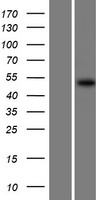 Western blot validation of overexpression lysate (Cat# LY410749) using anti-DDK antibody (Cat# TA50011-100). Left: Cell lysates from un-transfected HEK293T cells; Right: Cell lysates from HEK293T cells transfected with RC213378 using transfection reagent MegaTran 2.0 (Cat# TT210002).