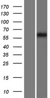 Western blot validation of overexpression lysate (Cat# LY416089) using anti-DDK antibody (Cat# TA50011-100). Left: Cell lysates from un-transfected HEK293T cells; Right: Cell lysates from HEK293T cells transfected with RC222307 using transfection reagent MegaTran 2.0 (Cat# TT210002).