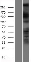 Western blot validation of overexpression lysate (Cat# LY408197) using anti-DDK antibody (Cat# TA50011-100). Left: Cell lysates from un-transfected HEK293T cells; Right: Cell lysates from HEK293T cells transfected with RC216509 using transfection reagent MegaTran 2.0 (Cat# TT210002).