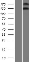 Western blot validation of overexpression lysate (Cat# LY424062) using anti-DDK antibody (Cat# TA50011-100). Left: Cell lysates from un-transfected HEK293T cells; Right: Cell lysates from HEK293T cells transfected with RC207887 using transfection reagent MegaTran 2.0 (Cat# TT210002).