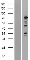 Western blot validation of overexpression lysate (Cat# LY424567) using anti-DDK antibody (Cat# TA50011-100). Left: Cell lysates from un-transfected HEK293T cells; Right: Cell lysates from HEK293T cells transfected with RC210211 using transfection reagent MegaTran 2.0 (Cat# TT210002).