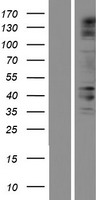 Western blot validation of overexpression lysate (Cat# LY421097) using anti-DDK antibody (Cat# TA50011-100). Left: Cell lysates from un-transfected HEK293T cells; Right: Cell lysates from HEK293T cells transfected with RC221444 using transfection reagent MegaTran 2.0 (Cat# TT210002).
