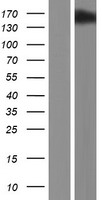 Western blot validation of overexpression lysate (Cat# LY414735) using anti-DDK antibody (Cat# TA50011-100). Left: Cell lysates from un-transfected HEK293T cells; Right: Cell lysates from HEK293T cells transfected with RC203502 using transfection reagent MegaTran 2.0 (Cat# TT210002).