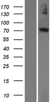Western blot validation of overexpression lysate (Cat# LY419966) using anti-DDK antibody (Cat# TA50011-100). Left: Cell lysates from un-transfected HEK293T cells; Right: Cell lysates from HEK293T cells transfected with RC217806 using transfection reagent MegaTran 2.0 (Cat# TT210002).