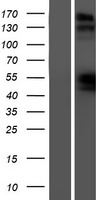 Western blot validation of overexpression lysate (Cat# LY418262) using anti-DDK antibody (Cat# TA50011-100). Left: Cell lysates from un-transfected HEK293T cells; Right: Cell lysates from HEK293T cells transfected with RC220459 using transfection reagent MegaTran 2.0 (Cat# TT210002).