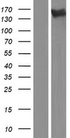 Western blot validation of overexpression lysate (Cat# LY421613) using anti-DDK antibody (Cat# TA50011-100). Left: Cell lysates from un-transfected HEK293T cells; Right: Cell lysates from HEK293T cells transfected with RC219135 using transfection reagent MegaTran 2.0 (Cat# TT210002).