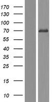 Western blot validation of overexpression lysate (Cat# LY411015) using anti-DDK antibody (Cat# TA50011-100). Left: Cell lysates from un-transfected HEK293T cells; Right: Cell lysates from HEK293T cells transfected with RC213655 using transfection reagent MegaTran 2.0 (Cat# TT210002).