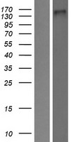 Western blot validation of overexpression lysate (Cat# LY424058) using anti-DDK antibody (Cat# TA50011-100). Left: Cell lysates from un-transfected HEK293T cells; Right: Cell lysates from HEK293T cells transfected with RC220172 using transfection reagent MegaTran 2.0 (Cat# TT210002).
