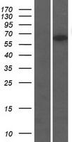 Western blot validation of overexpression lysate (Cat# LY411640) using anti-DDK antibody (Cat# TA50011-100). Left: Cell lysates from un-transfected HEK293T cells; Right: Cell lysates from HEK293T cells transfected with RC205980 using transfection reagent MegaTran 2.0 (Cat# TT210002).