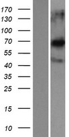 Western blot validation of overexpression lysate (Cat# LY409489) using anti-DDK antibody (Cat# TA50011-100). Left: Cell lysates from un-transfected HEK293T cells; Right: Cell lysates from HEK293T cells transfected with RC200937 using transfection reagent MegaTran 2.0 (Cat# TT210002).