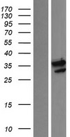 Western blot validation of overexpression lysate (Cat# LY415970) using anti-DDK antibody (Cat# TA50011-100). Left: Cell lysates from un-transfected HEK293T cells; Right: Cell lysates from HEK293T cells transfected with RC216698 using transfection reagent MegaTran 2.0 (Cat# TT210002).