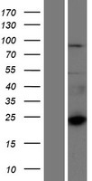 Western blot validation of overexpression lysate (Cat# LY405877) using anti-DDK antibody (Cat# TA50011-100). Left: Cell lysates from un-transfected HEK293T cells; Right: Cell lysates from HEK293T cells transfected with RC220150 using transfection reagent MegaTran 2.0 (Cat# TT210002).