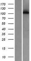 Western blot validation of overexpression lysate (Cat# LY408034) using anti-DDK antibody (Cat# TA50011-100). Left: Cell lysates from un-transfected HEK293T cells; Right: Cell lysates from HEK293T cells transfected with RC206699 using transfection reagent MegaTran 2.0 (Cat# TT210002).