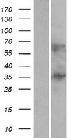 Western blot validation of overexpression lysate (Cat# LY409807) using anti-DDK antibody (Cat# TA50011-100). Left: Cell lysates from un-transfected HEK293T cells; Right: Cell lysates from HEK293T cells transfected with RC209490 using transfection reagent MegaTran 2.0 (Cat# TT210002).
