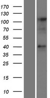 Western blot validation of overexpression lysate (Cat# LY427300) using anti-DDK antibody (Cat# TA50011-100). Left: Cell lysates from un-transfected HEK293T cells; Right: Cell lysates from HEK293T cells transfected with RC225528 using transfection reagent MegaTran 2.0 (Cat# TT210002).