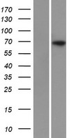 Western blot validation of overexpression lysate (Cat# LY418920) using anti-DDK antibody (Cat# TA50011-100). Left: Cell lysates from un-transfected HEK293T cells; Right: Cell lysates from HEK293T cells transfected with RC208782 using transfection reagent MegaTran 2.0 (Cat# TT210002).