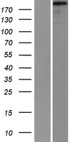 Western blot validation of overexpression lysate (Cat# LY418863) using anti-DDK antibody (Cat# TA50011-100). Left: Cell lysates from un-transfected HEK293T cells; Right: Cell lysates from HEK293T cells transfected with RC216323 using transfection reagent MegaTran 2.0 (Cat# TT210002).