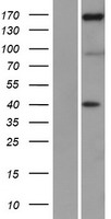 Western blot validation of overexpression lysate (Cat# LY426386) using anti-DDK antibody (Cat# TA50011-100). Left: Cell lysates from un-transfected HEK293T cells; Right: Cell lysates from HEK293T cells transfected with RC226407 using transfection reagent MegaTran 2.0 (Cat# TT210002).