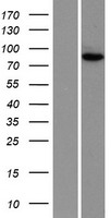 Western blot validation of overexpression lysate (Cat# LY419266) using anti-DDK antibody (Cat# TA50011-100). Left: Cell lysates from un-transfected HEK293T cells; Right: Cell lysates from HEK293T cells transfected with RC201806 using transfection reagent MegaTran 2.0 (Cat# TT210002).