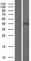 Western blot validation of overexpression lysate (Cat# LY427748) using anti-DDK antibody (Cat# TA50011-100). Left: Cell lysates from un-transfected HEK293T cells; Right: Cell lysates from HEK293T cells transfected with RC227488 using transfection reagent MegaTran 2.0 (Cat# TT210002).