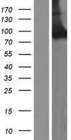 Western blot validation of overexpression lysate (Cat# LY423092) using anti-DDK antibody (Cat# TA50011-100). Left: Cell lysates from un-transfected HEK293T cells; Right: Cell lysates from HEK293T cells transfected with RC216338 using transfection reagent MegaTran 2.0 (Cat# TT210002).