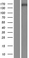 Western blot validation of overexpression lysate (Cat# LY418907) using anti-DDK antibody (Cat# TA50011-100). Left: Cell lysates from un-transfected HEK293T cells; Right: Cell lysates from HEK293T cells transfected with RC219682 using transfection reagent MegaTran 2.0 (Cat# TT210002).
