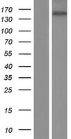 Western blot validation of overexpression lysate (Cat# LY414788) using anti-DDK antibody (Cat# TA50011-100). Left: Cell lysates from un-transfected HEK293T cells; Right: Cell lysates from HEK293T cells transfected with RC213620 using transfection reagent MegaTran 2.0 (Cat# TT210002).