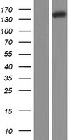 Western blot validation of overexpression lysate (Cat# LY413404) using anti-DDK antibody (Cat# TA50011-100). Left: Cell lysates from un-transfected HEK293T cells; Right: Cell lysates from HEK293T cells transfected with RC224847 using transfection reagent MegaTran 2.0 (Cat# TT210002).