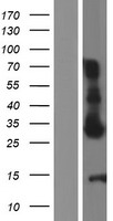 Western blot validation of overexpression lysate (Cat# LY432159) using anti-DDK antibody (Cat# TA50011-100). Left: Cell lysates from un-transfected HEK293T cells; Right: Cell lysates from HEK293T cells transfected with RC229135 using transfection reagent MegaTran 2.0 (Cat# TT210002).