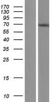 Western blot validation of overexpression lysate (Cat# LY406396) using anti-DDK antibody (Cat# TA50011-100). Left: Cell lysates from un-transfected HEK293T cells; Right: Cell lysates from HEK293T cells transfected with RC219262 using transfection reagent MegaTran 2.0 (Cat# TT210002).