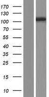 Western blot validation of overexpression lysate (Cat# LY433549) using anti-DDK antibody (Cat# TA50011-100). Left: Cell lysates from un-transfected HEK293T cells; Right: Cell lysates from HEK293T cells transfected with RC230549 using transfection reagent MegaTran 2.0 (Cat# TT210002).