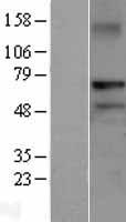 Western blot validation of overexpression lysate (Cat# LY402653) using anti-DDK antibody (Cat# TA50011-100). Left: Cell lysates from un-transfected HEK293T cells; Right: Cell lysates from HEK293T cells transfected with RC206907 using transfection reagent MegaTran 2.0 (Cat# TT210002).
