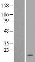 Western blot validation of overexpression lysate (Cat# LY402003) using anti-DDK antibody (Cat# TA50011-100). Left: Cell lysates from un-transfected HEK293T cells; Right: Cell lysates from HEK293T cells transfected with RC201578 using transfection reagent MegaTran 2.0 (Cat# TT210002).